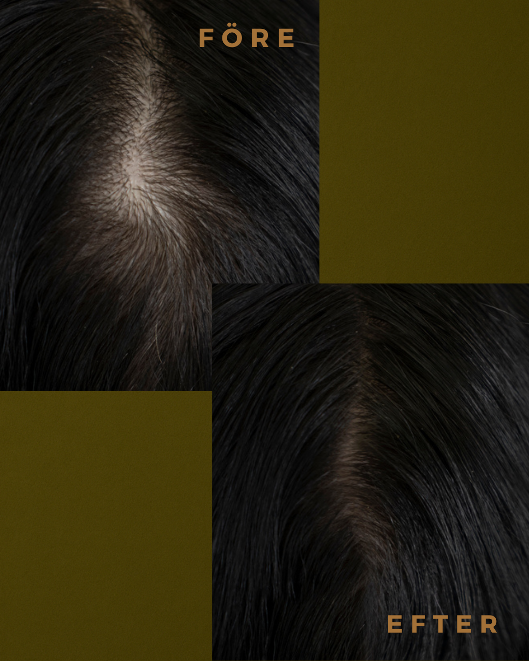 THAT EXTRA GROWTH: Rosemary LEAVE-IN Conditioner &amp; Scalp Care to boost hair growth