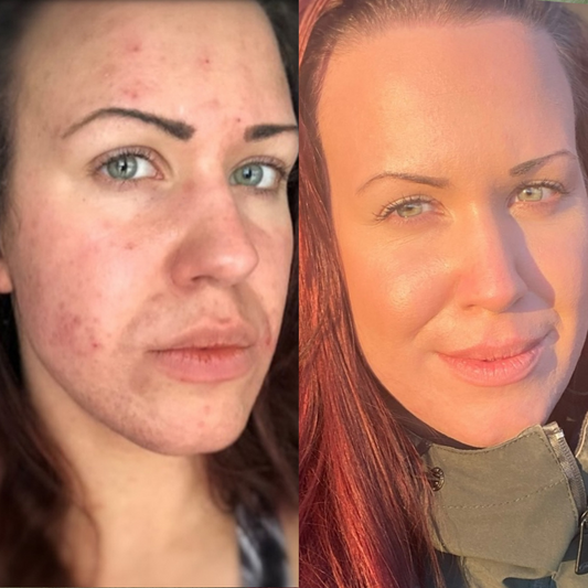 Deep Nourishing Cleansing Oil